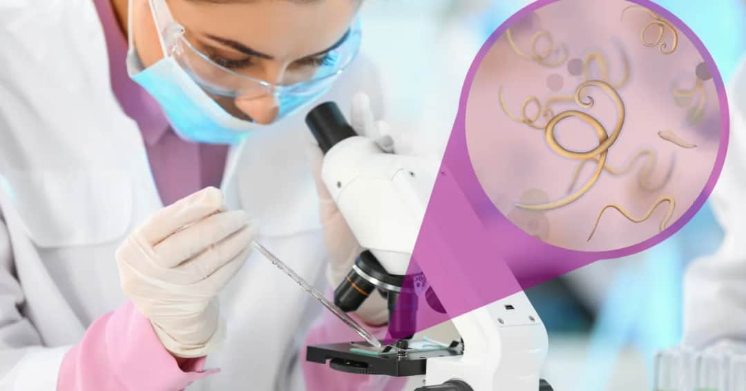 Skuteczne leki na pasożyty - co wybrać, aby uniknąć problemów? Skuteczne leki na pasożyty - co wybrać, aby uniknąć problemów?