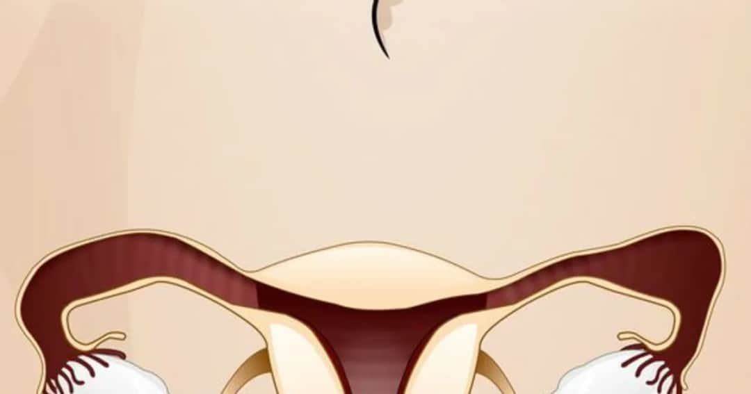 Jakie leki na zapalenie jajników skutecznie złagodzą ból i objawy