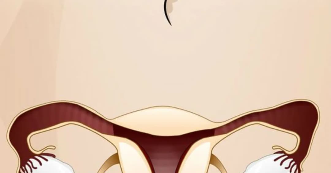 Jakie leki na zapalenie jajników skutecznie złagodzą ból i objawy