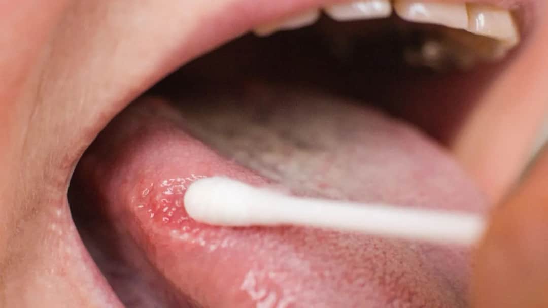 Do jakiego lekarza z językiem? Objawy, które wymagają wizyty