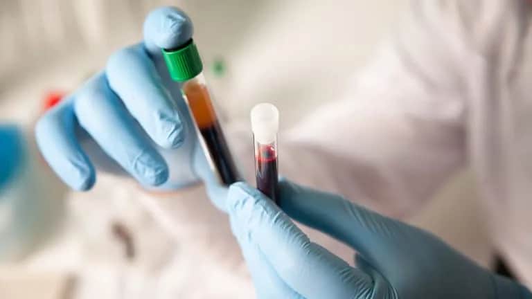 FT3 co to za badanie i jak wpływa na zdrowie tarczycy?